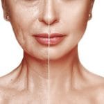 Facial Rejuvenation