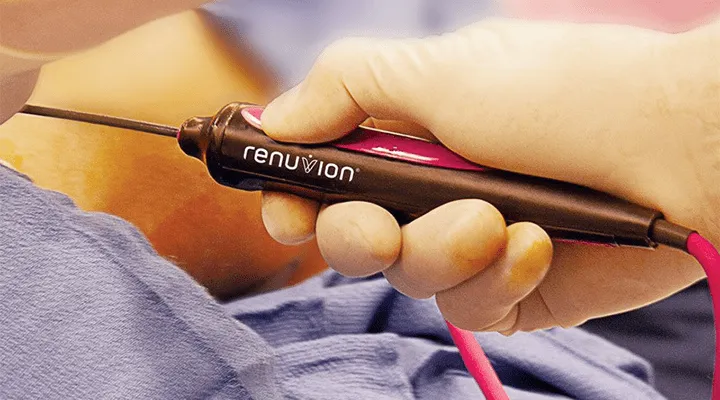 renuvion